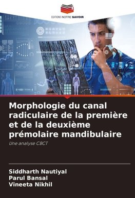 Morphologie du canal radiculaire de la première et de la deuxième prémolaire mandibulaire