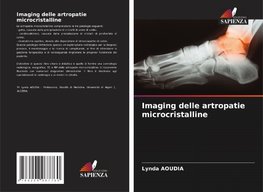 Imaging delle artropatie microcristalline