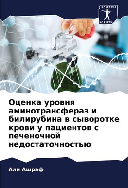 Ocenka urownq aminotransferaz i bilirubina w syworotke krowi u pacientow s pechenochnoj nedostatochnost'ü