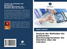 Analyse der Methoden der gesteuerten Knochenregeneration: Ein Überblick über die Literatur