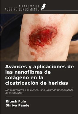 Avances y aplicaciones de las nanofibras de colágeno en la cicatrización de heridas