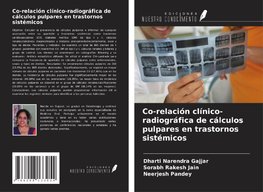 Co-relación clínico-radiográfica de cálculos pulpares en trastornos sistémicos