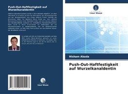 Push-Out-Haftfestigkeit auf Wurzelkanaldentin