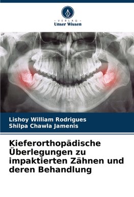 Kieferorthopädische Überlegungen zu impaktierten Zähnen und deren Behandlung