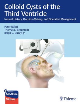 Colloid Cysts of the Third Ventricle