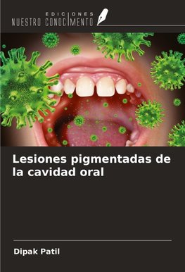 Lesiones pigmentadas de la cavidad oral