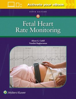 Fetal Heart Rate Monitoring