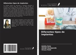 Diferentes tipos de implantes