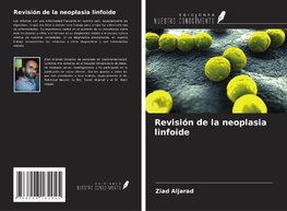 Revisión de la neoplasia linfoide