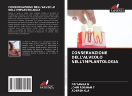 CONSERVAZIONE DELL'ALVEOLO NELL'IMPLANTOLOGIA