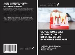 CARGA INMEDIATA FRENTE A CARGA DIFERIDA DE LOS IMPLANTES DENTALES