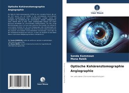 Optische Kohärenztomographie Angiographie