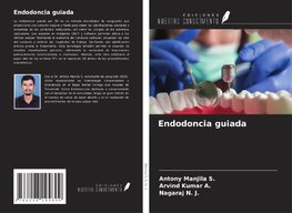 Endodoncia guiada