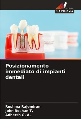 Posizionamento immediato di impianti dentali