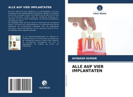 ALLE AUF VIER IMPLANTATEN