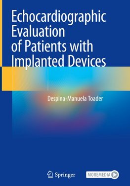 Echocardiographic Evaluation of Patients with Implanted Devices