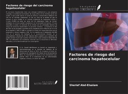 Factores de riesgo del carcinoma hepatocelular