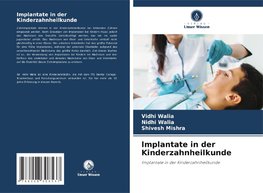 Implantate in der Kinderzahnheilkunde