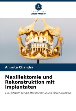 Maxillektomie und Rekonstruktion mit Implantaten