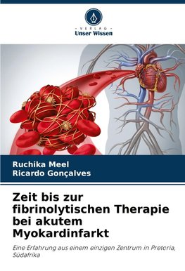 Zeit bis zur fibrinolytischen Therapie bei akutem Myokardinfarkt