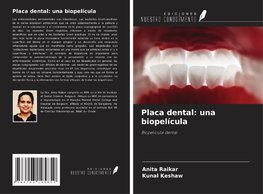 Placa dental: una biopelícula