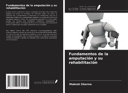 Fundamentos de la amputación y su rehabilitación