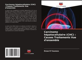 Carcinome hépatocellulaire (CHC) : Causes Traitements Vue d'ensemble