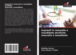 Impianti in mascelle e mandibole atrofiche mascella e mandibola