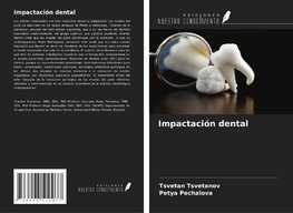 Impactación dental