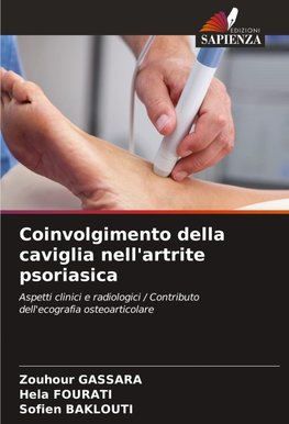 Coinvolgimento della caviglia nell'artrite psoriasica