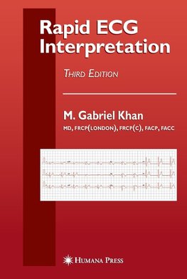 Rapid ECG Interpretation