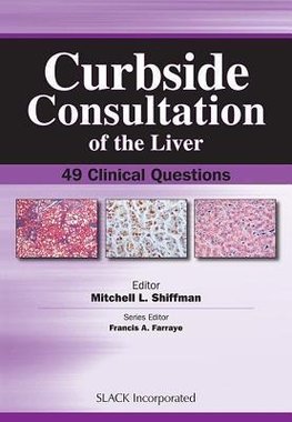 Curbside Consultation of the Liver