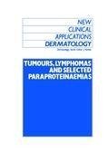 Tumours, Lymphomas and Selected Paraproteinaemias