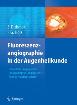 Fluoreszenzangiographie in der Augenheilkunde