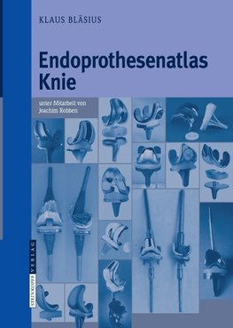 Endoprothesenatlas Knie