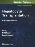 Hepatocyte Transplantation