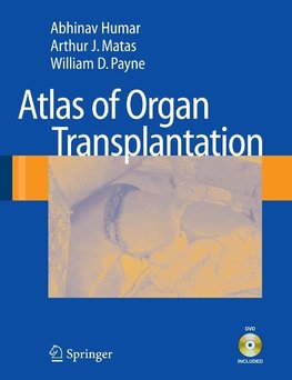 Atlas of Organ Transplantation