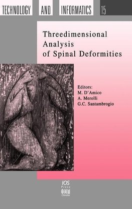 Threedimensional Analysis of Spinal Deformities