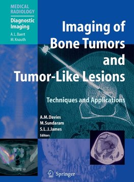 Imaging of Bone Tumors and Tumor-Like Lesions