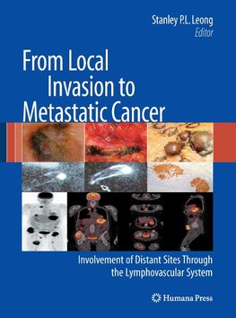 From Local Invasion to Metastatic Cancer