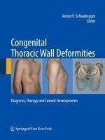 Congenital Thoracic Wall Deformities