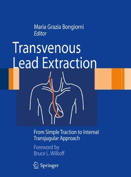 Transvenous Lead Extraction