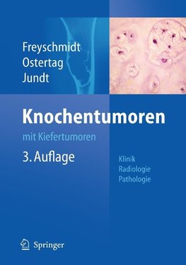 Knochentumoren mit Kiefertumoren