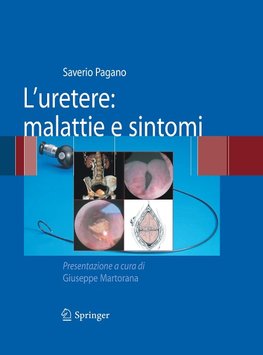 L'uretere: malattie e sintomi