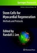 Stem Cells for Myocardial Regeneration