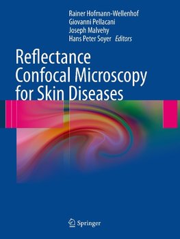 Reflectance Confocal Microscopy for Skin Diseases