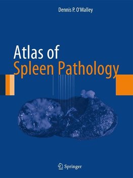 Atlas of Spleen Pathology