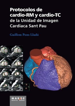 Protocolos de cardio-RM y cardio-TC de la Unidad de Imagen Cardiaca Sant Pau