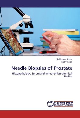 Needle Biopsies of Prostate