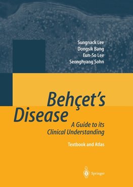 Behçet's Disease